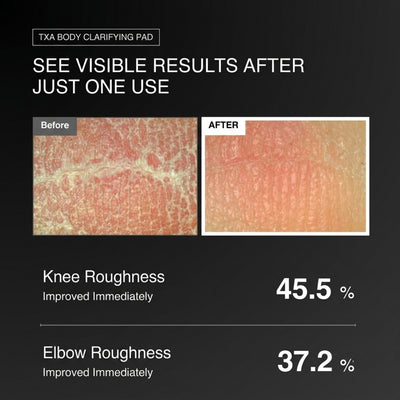 Body Clarifying Pad