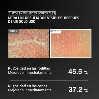 Discos Exfoliantes Corporales