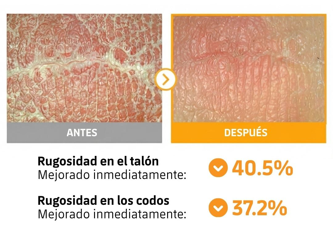 Resultados visibles